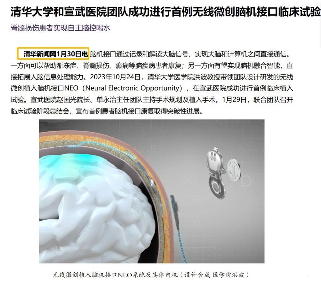 脑机接口人体试验首次取得成功